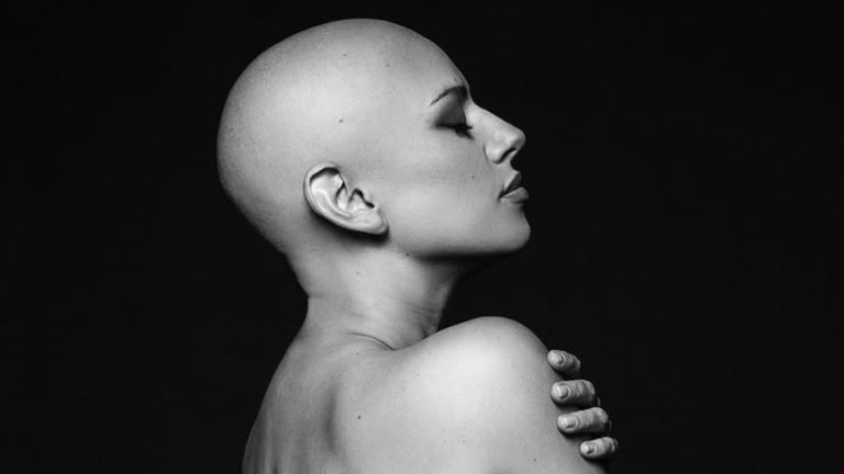 “Me niego a esconderme”: Karla Melo emocionó con reflexión y foto tras sexta quimioterapia