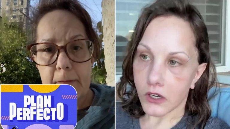 ¡20 años menos! Estas son las cirugías faciales en tendencia para lograr un rostro rejuvenecido