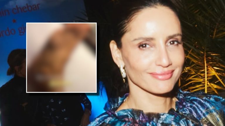 “Triple fractura”: Leonor Varela sufre complejo accidente doméstico en México y revela su estado de salud