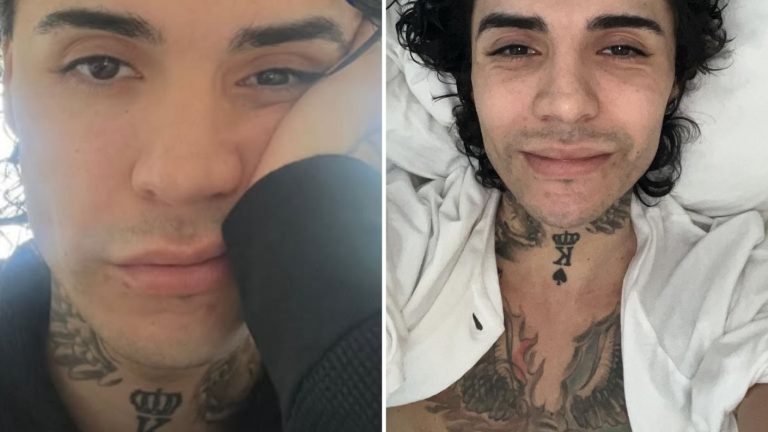 “Ser acusado de drogadicto...”: Leo Méndez Jr. reveló cómo le afectaron las críticas a su salud