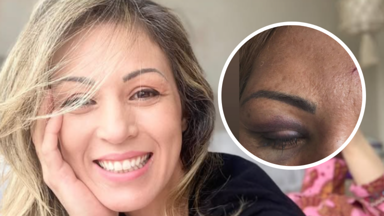 ExMekano, Ariela Medeiros, denunció golpiza de su pareja y este se dio a la fuga