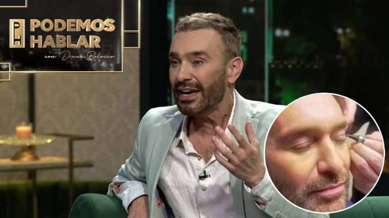 Jordi Castell impactó con radical cambio en su cara: Se hizo retoque estético poco conocido