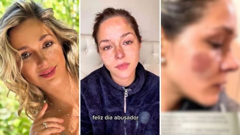 ¿Quién es Nicole Block? La actriz que impactó con acusación de maltrato y VIF