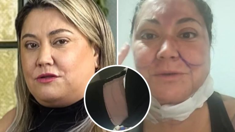 “Estoy en conversaciones”: Denisse Campos reveló la razón detrás de múltiple intervención estética