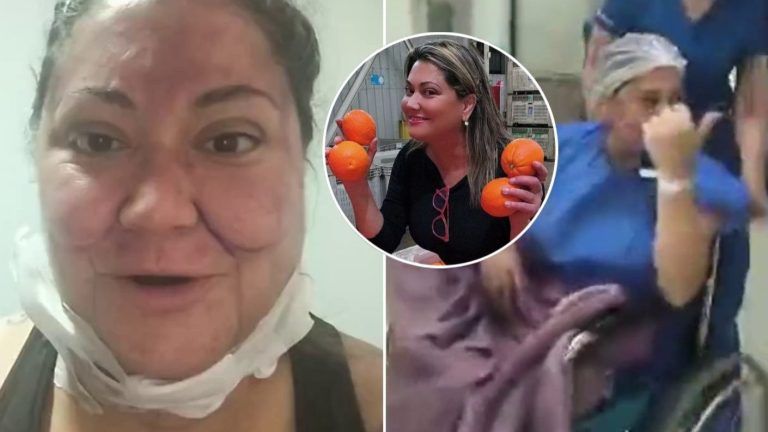 Denisse Campos volvió al trabajo tras 6 cirugías y preocupó a seguidores: Así luce ahora