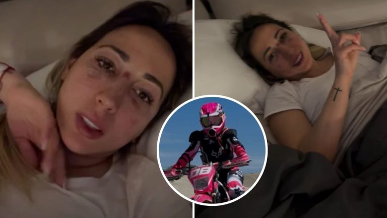 Rebeca Naranjo reveló grave consecuencia de salud tras accidente en moto: “Tengo una...”