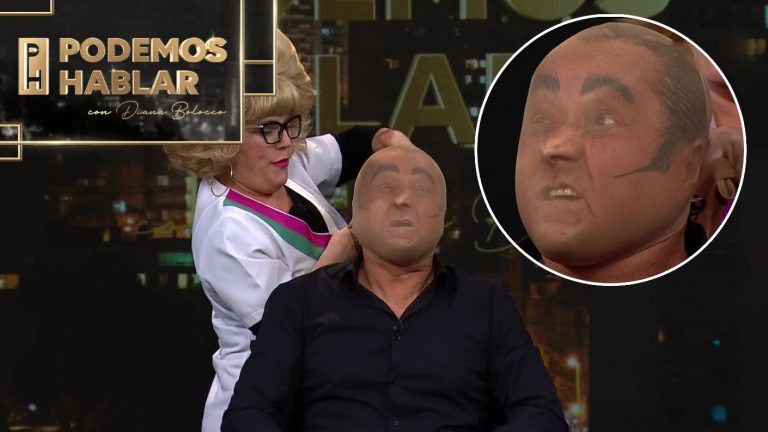 ¡De su propia medicina! Ivanna Lamer hizo lo posible para intentar rejuvenecer a Yerko Puchento