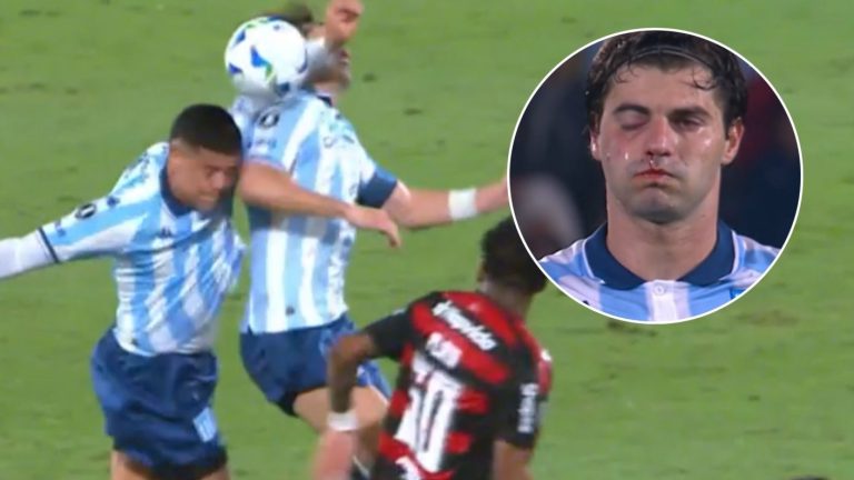 Capitán de Racing sufrió fractura tras golpe en la cara de compañero: Se perderá revancha vs Flamengo