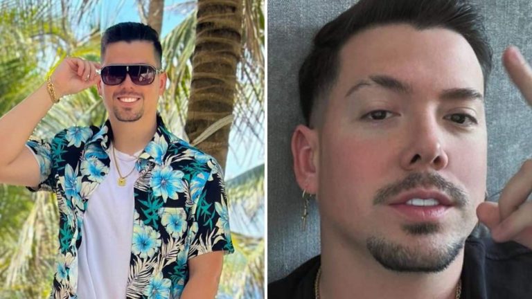 FOTO | “Más que conforme”: Nano Calderón se sometió a popular procedimiento estético