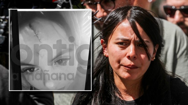 Así quedó el rostro de Cristal Aguilera, hermana de Krishna, tras sufrir brutal agresión