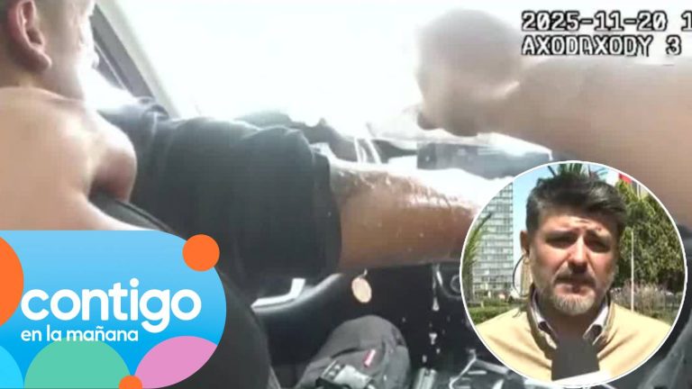 “Tiene que hacerse injerto”: Guardia municipal tuvo grave secuela tras ataque con aceite hirviendo en Meiggs