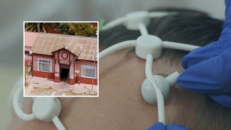 “Sentí una corriente”: El relato de paciente sometido a electroshock sin anestesia en hospital de Valparaíso