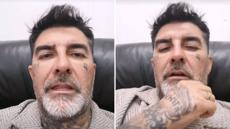 “No puedo mover mucho”: DJ Méndez actualizó su estado de salud tras violento atropello en Isla de Maipo