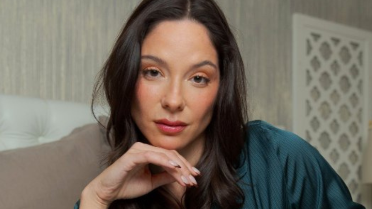 “No la reconocí”: Kel Calderón impacta en TikTok por supuesto retoque estético