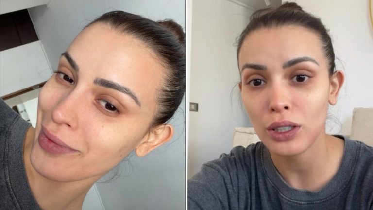 Cony Capelli actualiza su estado de salud y revela si bailará o no en el aquadance: “Una infección fuerte”