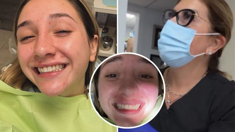 ANTES Y DESPUÉS | Mamá de Matt Hunter le hizo costoso procedimiento estético a su nuera, Carla Inostroza