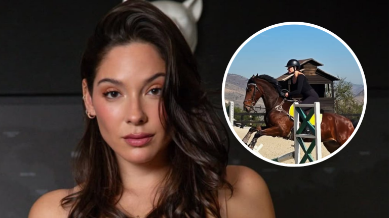 Kel Calderón mostró las consecuencias que le dejó fuerte accidente a caballo