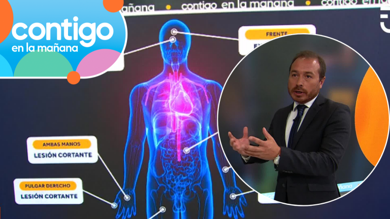 “Son signos de defensa”: Experto analizó las 8 lesiones de Jorge Ugalde tras su detención por crimen en La Reina