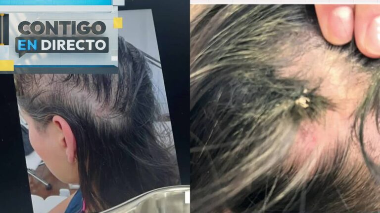 Clientes acusan a peluquería de daño irreversible y caída de mechones de pelo: Al menos habría 10 afectadas