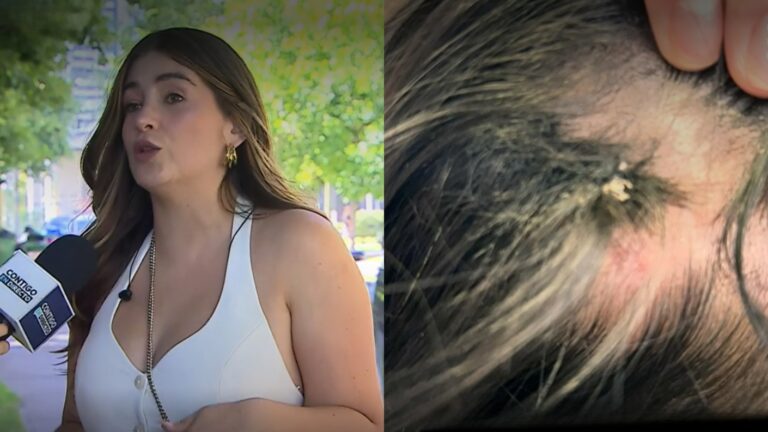 “Desde que me colocaron las extensiones comenzaron las…”: Los testimonios de clientas que denuncian a salón de belleza