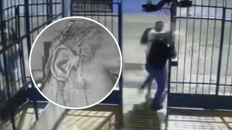 Conserje sufrió brutal golpiza en Santiago: Residente lo agredió con una botella en la cabeza