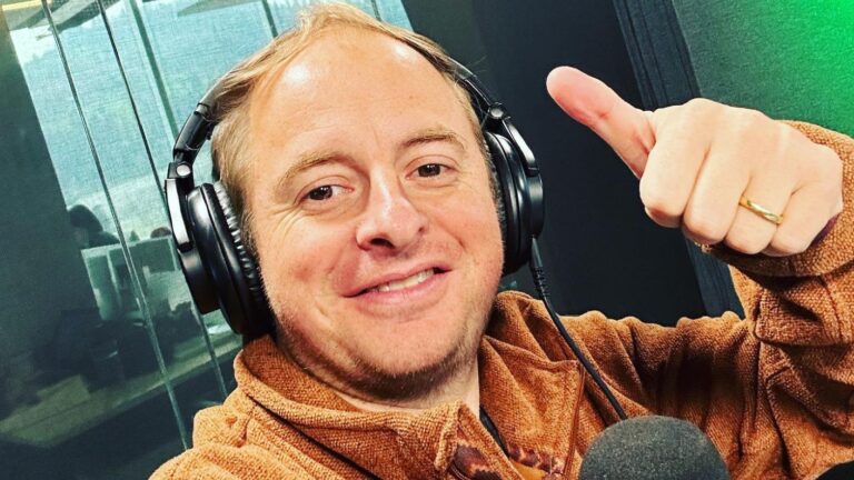 Antes y después: Así luce Coke Hevia a un año de su implante de cabello