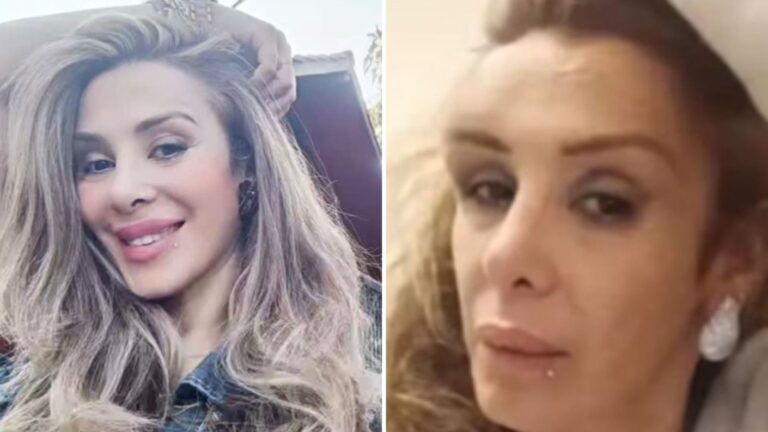 “Me dijo que me iba a matar”: Exchica Mekano fue víctima de brutal agresión al interior de discoteque capitalina