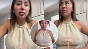 “Es una lucha que tengo que llevar”: Naya Fácil mostró las secuelas que le dejó una mala intervención estética