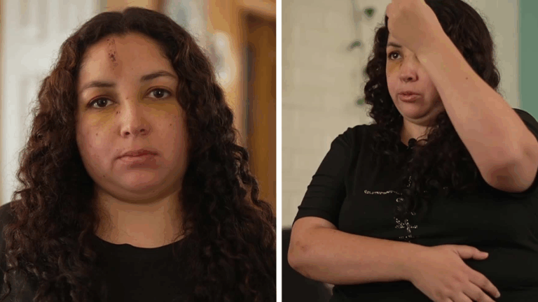 EXCLUSIVO | Habla trabajadora agredida en residencia de menores: “Ella estaba con un cuchillo”