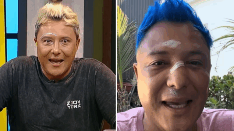 “Salió mucha sangre…”: Sergio Rojas reveló fuerte accidente que lo tuvo fuera de pantalla