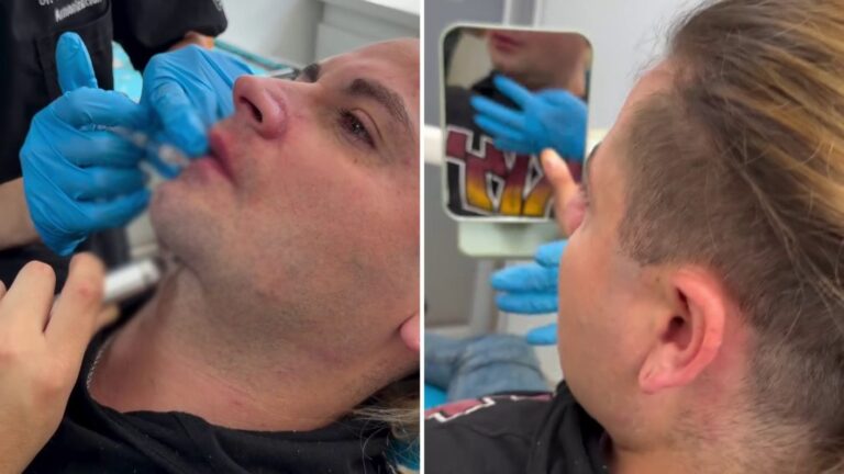 “Rostro más armónico”: Princeso sorprendió al mostrar resultados tras intervenciones estéticas