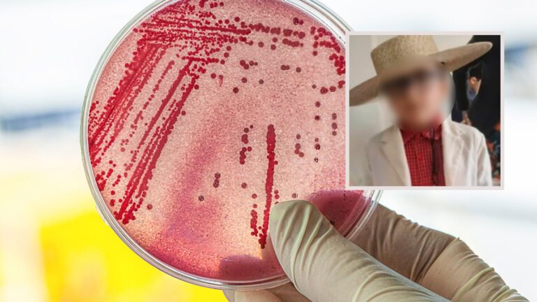 ¿Qué es la Escherichia coli? La bacteria que provocó la muerte de un niño de 8 años tras comer hamburguesa en Curanilahue