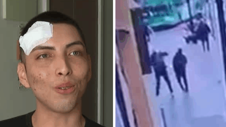 VIDEO | Le cayó pesa de 3 kilos en el rostro: Transeúnte salvó de milagro