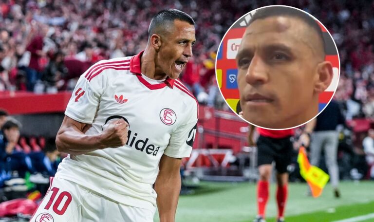 Con un chichón: Así quedó el rostro de Alexis Sánchez tras marcar vital gol para el Sevilla