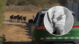 Consternación en Laguna Verde: Adulto mayor queda con heridas graves tras ser atacado por jauría de perros