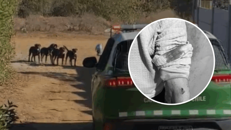 Consternación en Laguna Verde: Adulto mayor queda grave tras ser atacado por jauría de perros