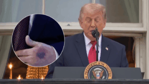 Dudas por salud de Donald Trump: Revelan detalles de su chequeo médico