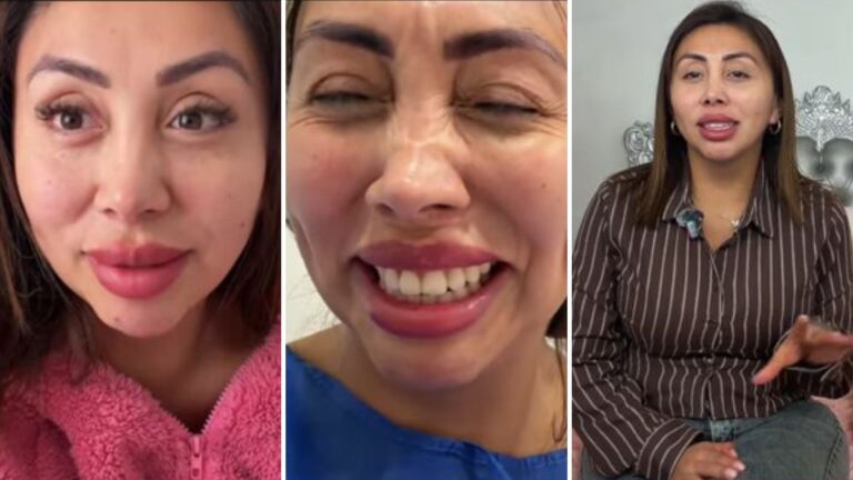 Tras 48 horas desaparecida: Naya Fácil regresó a redes sociales tras intervención quirúrgica estética