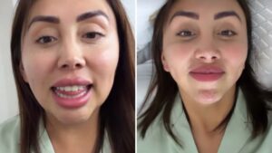 Naya Fácil mostró el antes y después de su operación en redes: 