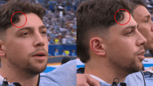 ¿Lo notaste? La cicatriz de Fede Valverde que se logró apreciar durante la entonación del himno de Uruguay