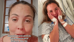 Chris McMillan sufrió duro revés en su recuperación: Reveló que podría perder la movilidad de su pierna