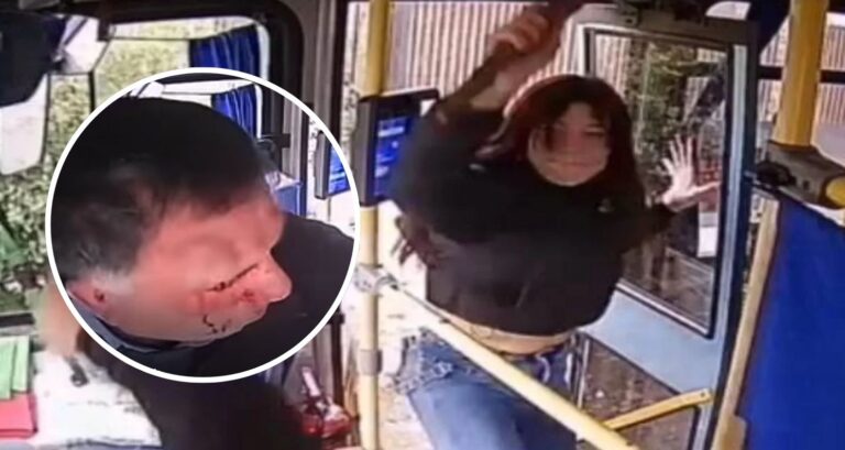 Micrero terminó ensangrentado tras brutal agresión en Chillán: 