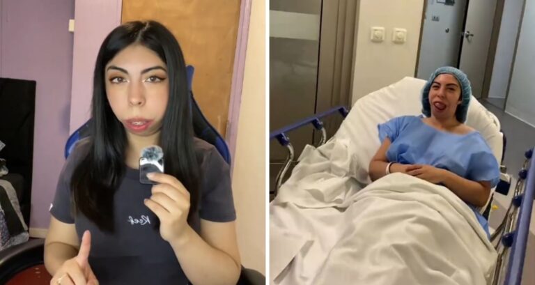 Joven chilena impactó al mostrar resultado de esperada cirugía tras reunir $38 millones