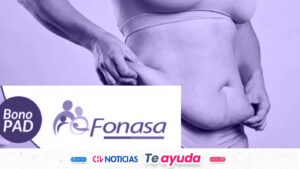 Bono PAD Abdominoplastia: Quiénes pueden optar a la cirugía de 