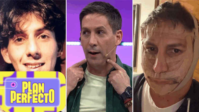 Un impactante antes y después: Pato Sotomayor reveló insólitos detalles de sus procedimientos estéticos